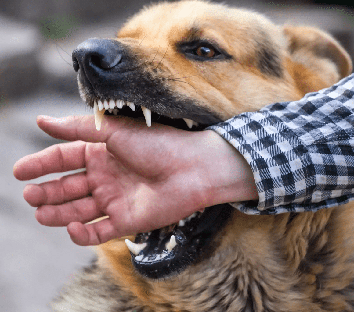 Dog biting a person's hand
